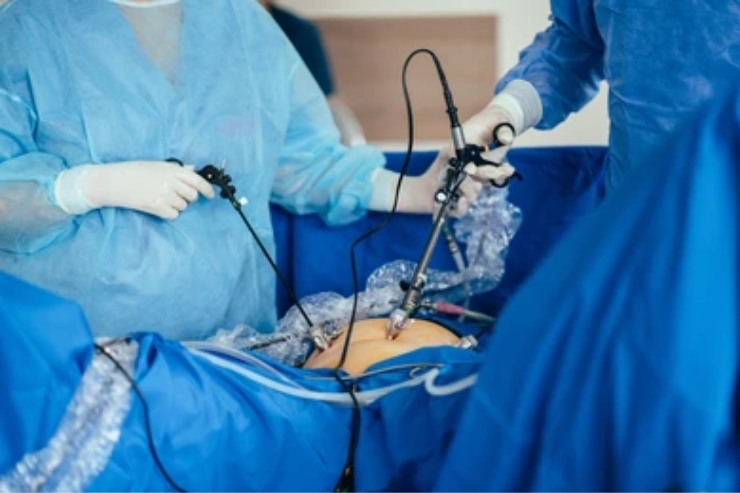 Fertility Enhancing Laparoscopic Surgeries