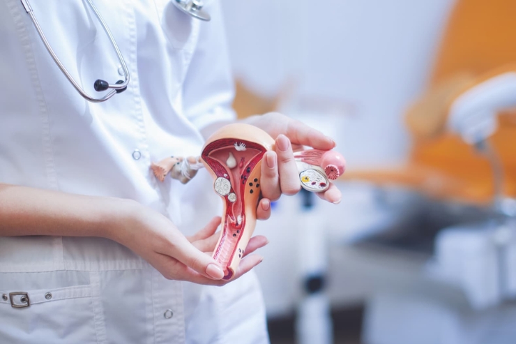 Laparoscopic Completion Hysterectomy