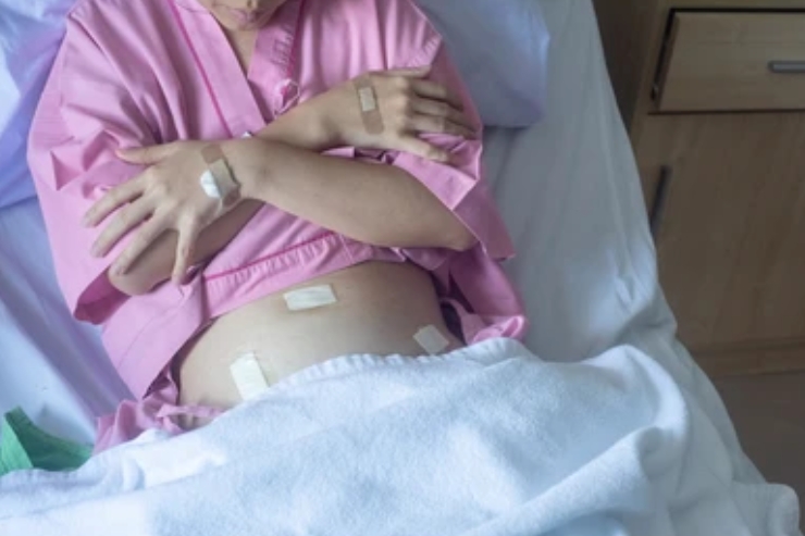 Laparoscopic Wertheim's Hysterectomy